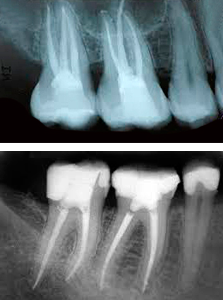 endodonzia-2